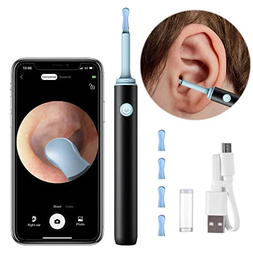 Smart Wireless Ear Cleaner Tool with 1080P HD Otoscope Camera for Ear & 6 LED Lights - High Precision Ear Wax Removal Kit for Safe & Easy Ear Cleaning
